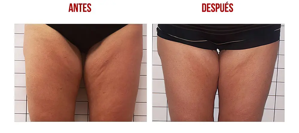 testimonios-clientes-12-low_res-scale-2_00x